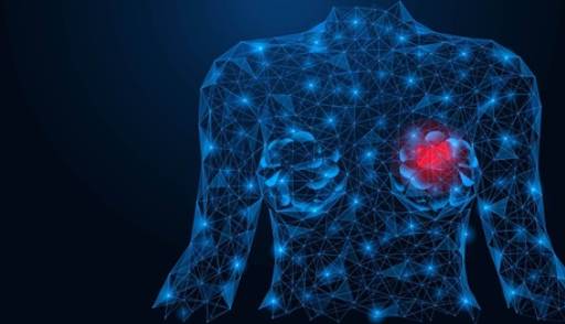 Breast cancer white paper