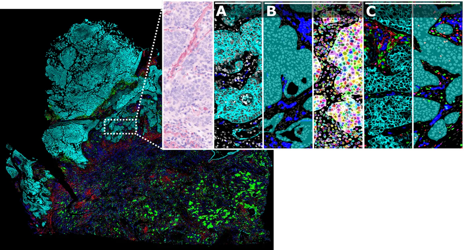 AI-driven image analysis